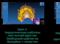 Образовательный курс по хирургическим конструкциям на платформе RealGuide