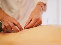 Китайское лечение иглоукалывание